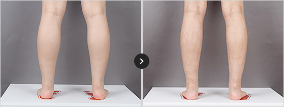 365mc BEFORE & AFTER