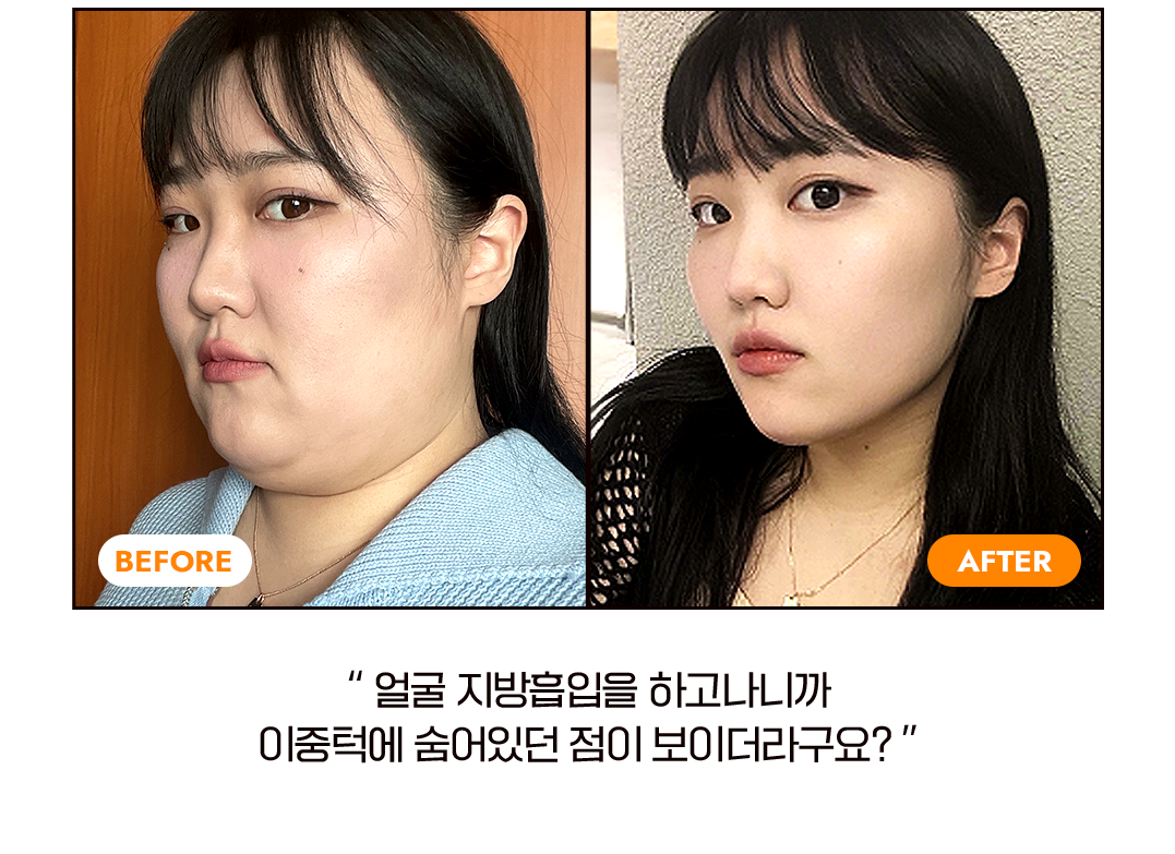 before after
