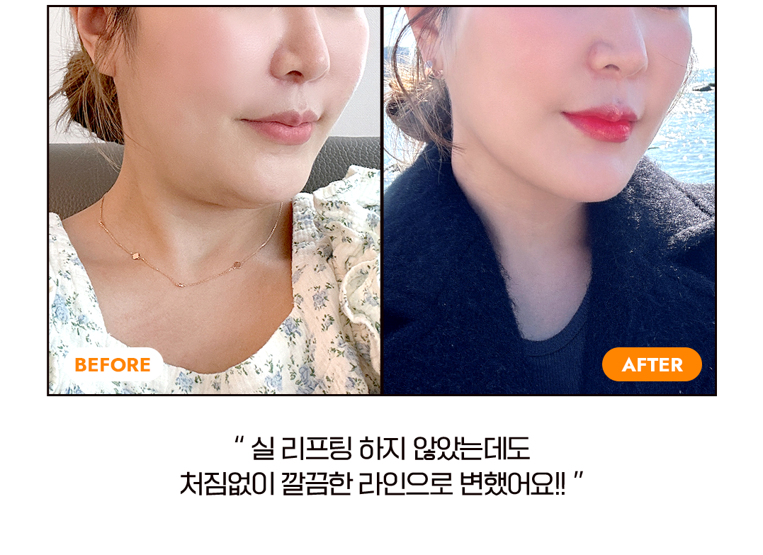 before after